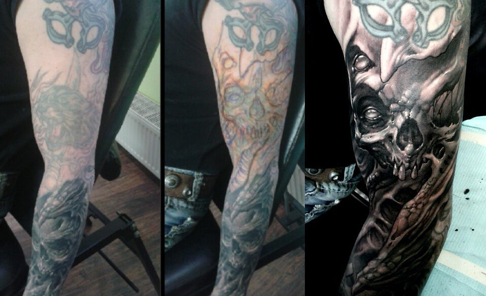 Before & Freehand on Lasered Arm